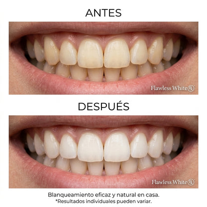 Blanqueador Dental