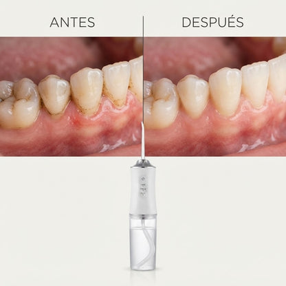 Irrigador Bucal Limpiador Dientes